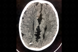 Texto alternativo para a imagem