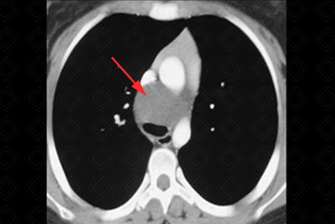 Texto alternativo para a imagem