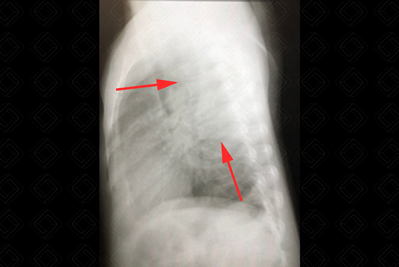 Texto alternativo para a imagem