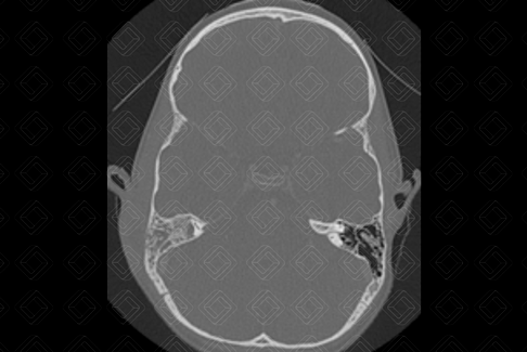 Texto alternativo para a imagem