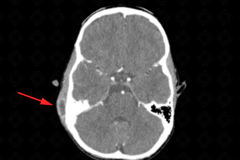 Texto alternativo para a imagem