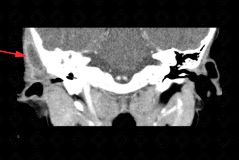 Texto alternativo para a imagem