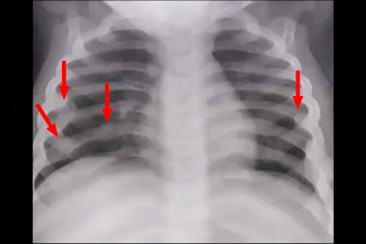 Texto alternativo para a imagem