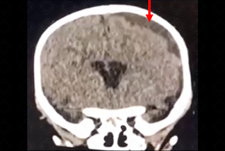 Texto alternativo para a imagem