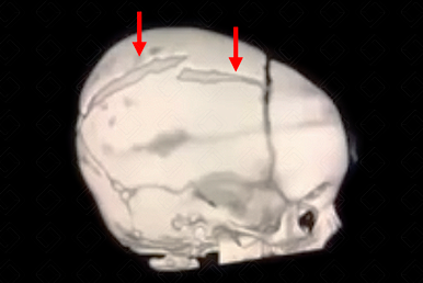 Texto alternativo para a imagem