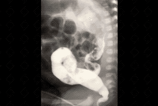 Texto alternativo para a imagem