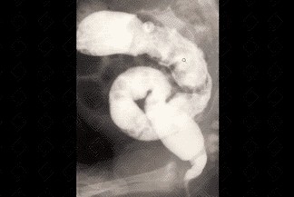 Texto alternativo para a imagem