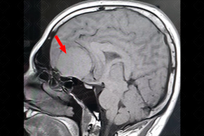 Texto alternativo para a imagem