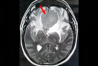 Texto alternativo para a imagem