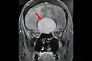 Texto alternativo para a imagem