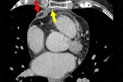 Texto alternativo para a imagem