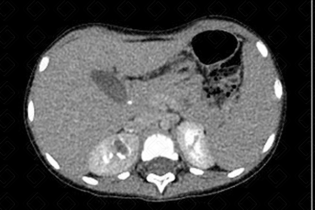 Texto alternativo para a imagem