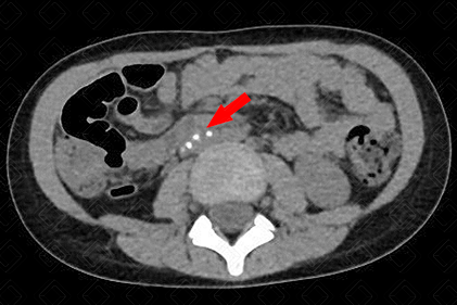 Texto alternativo para a imagem