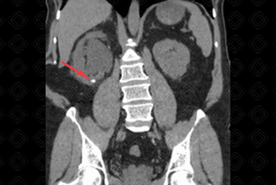 Texto alternativo para a imagem