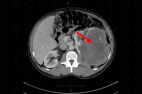 Texto alternativo para a imagem