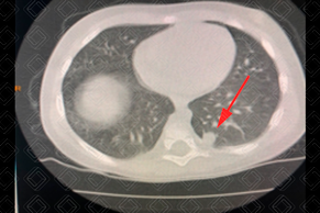 Texto alternativo para a imagem