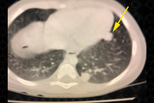 Texto alternativo para a imagem