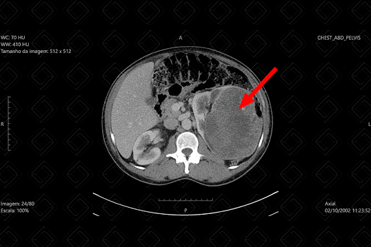Texto alternativo para a imagem