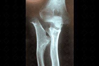 Texto alternativo para a imagem