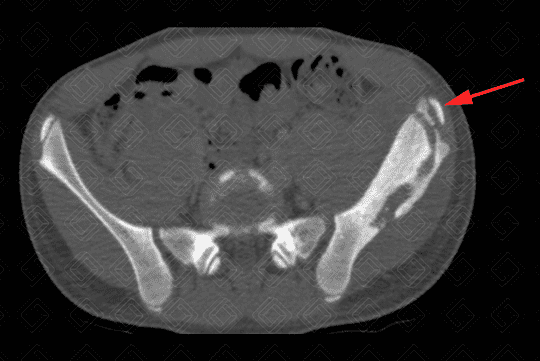 Texto alternativo para a imagem