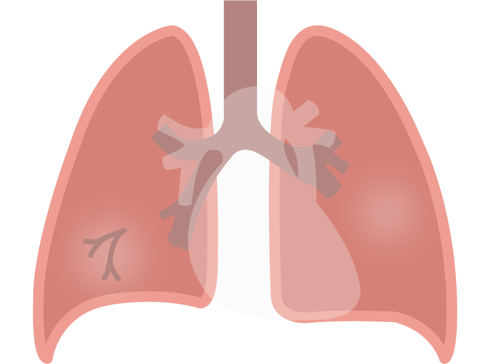 Texto alternativo para a imagem