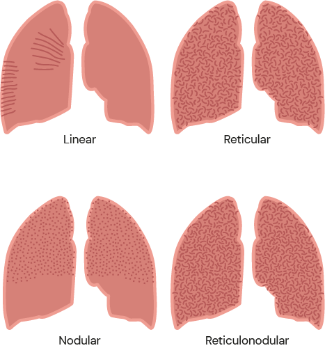 Texto alternativo para a imagem