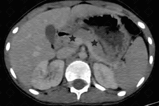 Texto alternativo para a imagem