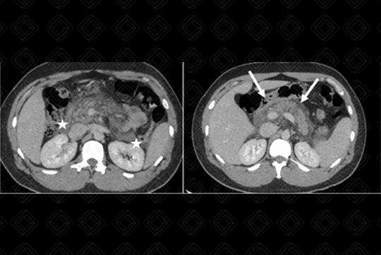 Texto alternativo para a imagem