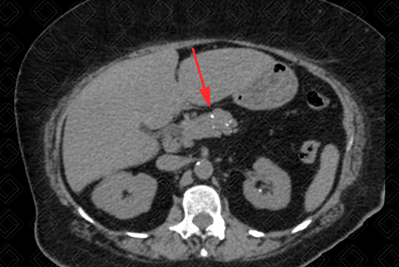 Texto alternativo para a imagem