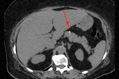 Texto alternativo para a imagem