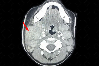 Texto alternativo para a imagem