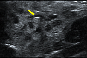 Texto alternativo para a imagem