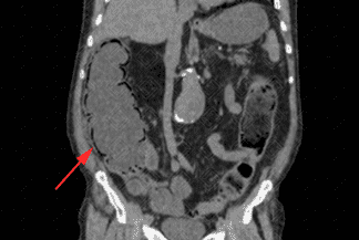 Texto alternativo para a imagem