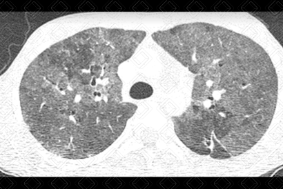 Texto alternativo para a imagem