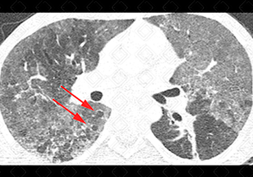 Texto alternativo para a imagem