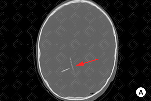 Texto alternativo para a imagem