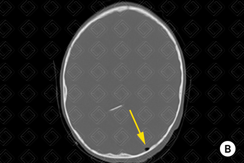 Texto alternativo para a imagem