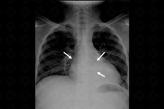 Texto alternativo para a imagem