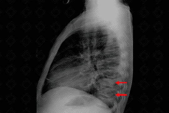 Texto alternativo para a imagem