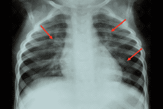 Texto alternativo para a imagem