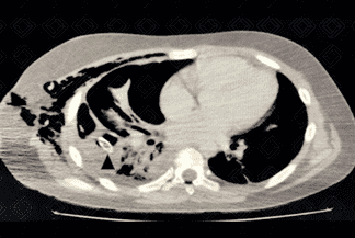 Texto alternativo para a imagem