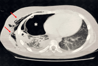 Texto alternativo para a imagem