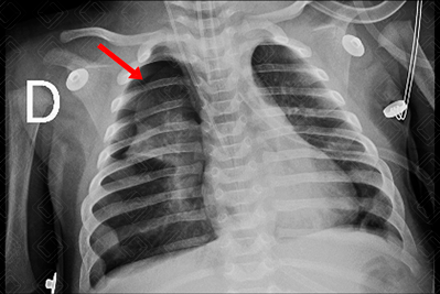 Texto alternativo para a imagem