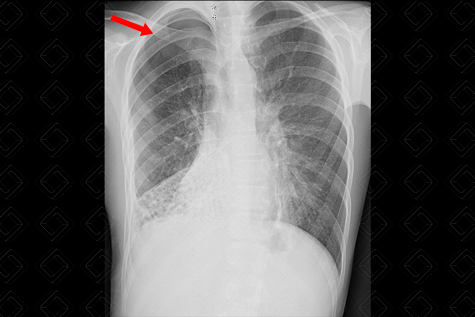 Texto alternativo para a imagem