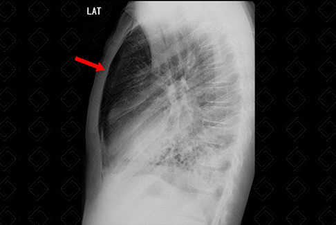 Texto alternativo para a imagem