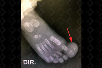 Texto alternativo para a imagem