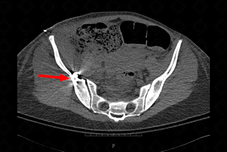 Texto alternativo para a imagem