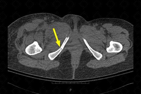 Texto alternativo para a imagem