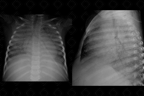 Texto alternativo para a imagem