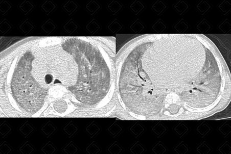 Texto alternativo para a imagem